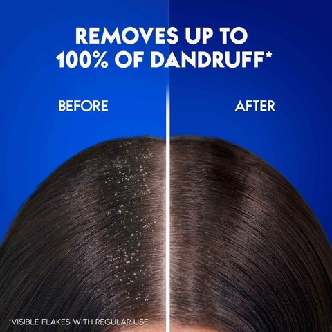 Head &amp; Shoulders Charcoal Detox Anti-Dandruff Shampoo, 400ml