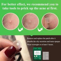 Breylee Acne Pimple Patch Stickers Acne Treatment Pimple Remover Tool Blemish Spot Facial Mask Skin Care Waterproof 22 Patches