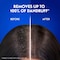 Head &amp; Shoulders Men Hairfall Defense Anti-Dandruff Shampoo, 400ml
