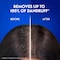 Head &amp; Shoulders Classic Clean Anti-Dandruff Shampoo for Normal Hair 1000ml