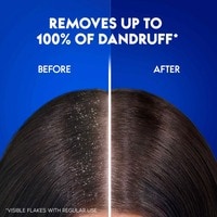 Head &amp; Shoulders Menthol Refresh Anti-Dandruff Shampoo for Itchy Scalp 400ml Pack of 2