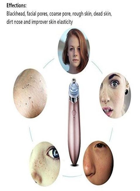 Generic Blackhead Remover Electronic Facial Pore Cleaner Acne Vacuum