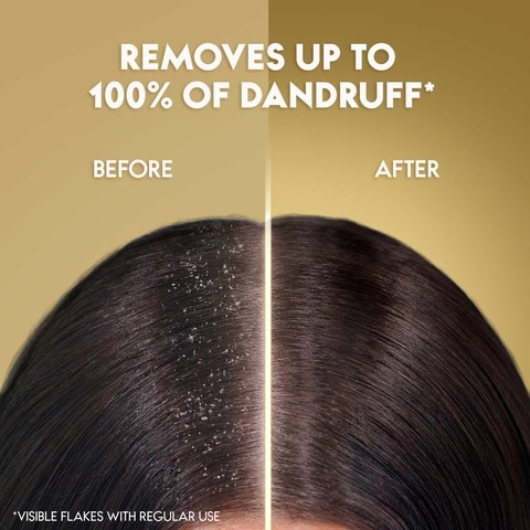Head &amp; Shoulders Supreme Anti-Dandruff Shampoo With Argan Oil And Aloe Vera For Sensitive Scalp Soothing 200ml