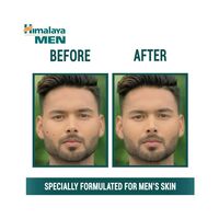 Himalaya Herbals Men Pimple Clear Neem Face Wash Green 100ml