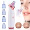 Doreen Blackhead Remover